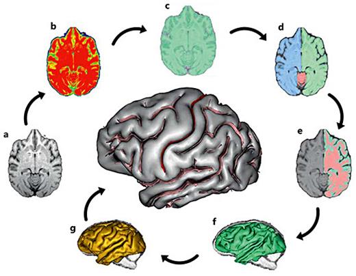 Fig. 1. BrainVisa's pipeline processing steps. a MRI of a skull-stripped chimpanzee brain. b Stable tissue intensities after bias field correction. c Binary mask of the brain. d Split mask of left and right hemispheres and cerebellum. e Gray and white interface. f Negative mold of the white matter. g Skeletonized mold of cortical folding. h Cortical fold graph of chimpanzee sulci with the CS in red.