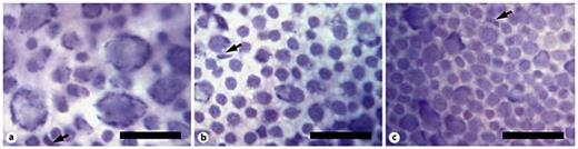 High-magnification digital photographs showing Nissl-stained neurons in the RGC layer in P. superciliosus. Cells in the far naso-dorsal periphery (∼14,000 cells·mm-2) (a), the ventro-cental retina (∼25,000 cells·mm-2) (b), and the central retina close to the area of peak cell density (∼44,000 cells·mm-2) (c). Glial cells, which were not included in the neuron counts, are marked with arrows. Scale bars = 20 μm.