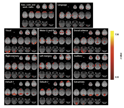  Resting-state networks in humans. Networks are presented overlaid on axial slices of a human’s brain. Data was calculated with the same methodology as that in Figure 1. The networks shown are executive control and working memory (merged), visual, ventral salience, dorsal salience, right and left memory, audition, default parts 1 and 2, extrastriate, and motor (left and right). The pseudo-colored scale indicates levels of statistical significance.