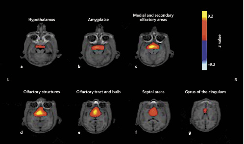 Working memory brain activity in the spider monkey. The figure shows seven axial slices, with the spatial color-coded z map components overlaid on the echo-planar image obtained from the mean for the three subjects. A higher z score (yellow) represents a higher correlation between the time course of that voxel and the mean time course of this component. Mean components comprise the hypothalamus (a), the amygdalae (b), the medial and secondary olfactory areas (c), the olfactory structures (d), the olfactory tract and bulb (e), the septal areas (f), and the gyrus of the cingulum (g).