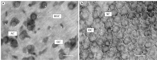 Fig. 3. Photomicrographs. a Retinal ganglion cell layer. ×100. b Photoreceptor layer showing the square cone mosaic. ×100. RGC, retinal ganglion cell; GC, glial cell; AC putative amacrine cell; DC double cone; SC, single cone. The scale bar is 10 µm in length.