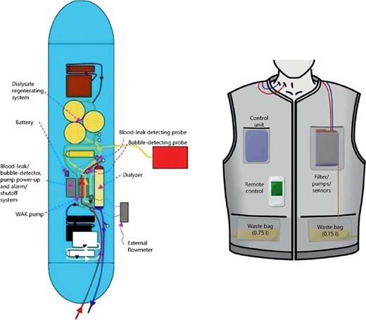 Fig. 1. Schematics of the current Gura WAK system and the prototype Vicenza WAKMAN.