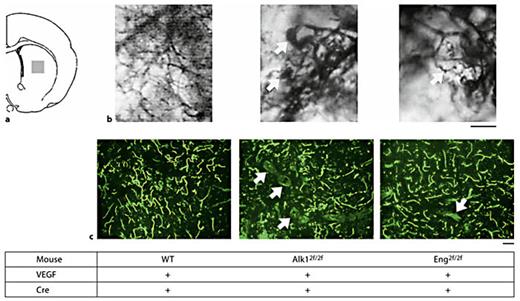 Fig. 1. Dysplastic cerebral vasculature was detected in the Ad- Cre and AAV-VEGF-injected brain of Alk12f/2f and Eng2f/2f mice. a Diagram indicates the viral vector injection site (gray square). b Representative images of the microfil-perfused brain. Injection of Ad-Cre with AAV-VEGF to the WT brain caused focal normal angiogenesis, while it induced localized dysplastic vessel formation in the Alk12f/2f and Eng2f/2f brain (arrows). c Representative images of lectin-perfused brain sections. Dysplastic vessels were observed in the Ad-Cre/AAV-VEGF-injected Alk12f/2f and Eng2f/2f brain (arrows), but not in the similarly treated WT brain. Scale bars are 100 µm (b) and 50 µm (c).