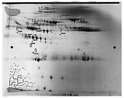 Fig. 3. A representative 2D-DIGE image consisting of a single Cy5-labeled symptomatic EA patient serum, a Cy3-labeled asymptomatic EA patient serum and a Cy2-labeled internal standard control sample. The spots indicated with circles locate the position of the 11 differentially expressed spots with p < 0.01.