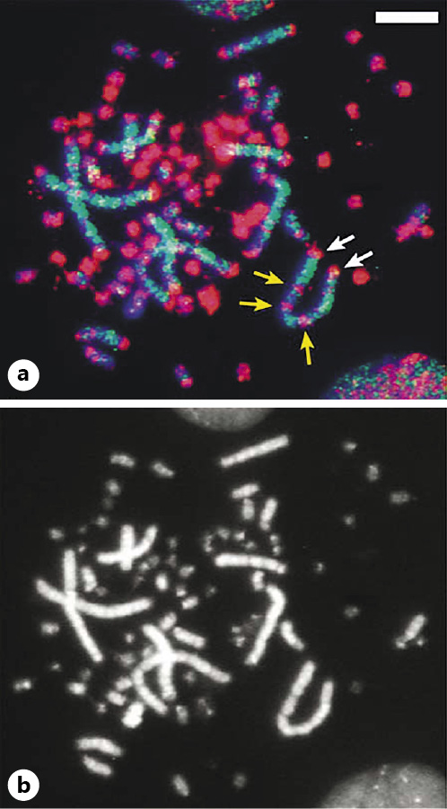  Hybridization of GC-rich and GC-poor DNA probes on chicken chromosomes. Chicken DNA fractions characterized as having the lowest and the highest GC levels were hybridized to chicken chromosomes. a The DNA fraction with the highest GC level (red signals) was localized to the microchromosomes and to telomeric bands of the macrochromosomes (see white arrows as examples). Some internal bands of the macrochromosomes also hybridized (see yellow arrows as examples). In contrast, the DNA fraction with the lowest GC levels (green signals) localized to the internal bands of the macrochromosomes. b The same metaphase shown in the panel is DAPI stained in order to better show microchromosomes. The bar in the upper right is 5 μm long. Figure taken from Federico et al. [2005].