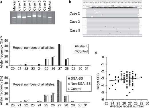 Representative results of repeat number analysis. a Agarose gel electrophoresis. The repeat numbers of cases 1–6 were assessed as 26/27, 26/26, 27/27, 27/28, 28/28, and 27/27, respectively. b Long-read NGS for cases 2, 3, and 5. Case 3 carried the same repeat number as the human reference genome (n = 27), while cases 2 and 5 had 26 and 28 repeats, respectively. c Distributions of repeat numbers of all alleles in the patient and control groups (the upper panel) and in the SGA-SS, non-SGA ISS, and control groups (the lower panel). d Correlation analysis between repeat numbers and height SDSs. No significant correlation was observed (Pearson correlation coefficient 0.112, p = 0.253).