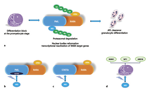 When Poisons Cure: The Case of Arsenic in Acute Promyelocytic Leukemia ...