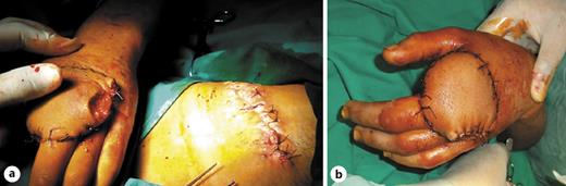 Fig. 4. a, b Division done on the 3rd week.