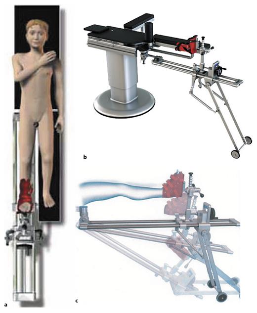 Fig. 2. Illustration of the setup for the operation, with the patient in supine position, with the leg to be operated on fixated on a mobile traction hemi-table (Mobile Leg Holder, Medacta, Castel San Pietro, Switzerland) (a, b). The table allows for stable positioning of the leg including traction, rotation, abduction/adduction, and hyperextension of the hip (c). The system releases traction automatically when hyperextension is performed, in order to reduce the risk for traction injuries. Illustrations from the instructions for use from the manufacturer.