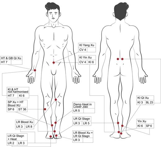 Acupuncture figure showing syndromes and acupoints. KI Yin xu: KI 6, CV 4, KI Qi xu: KI 3, BL 23, Ki and HT not harmonised: HT 7, KI 6, LR Qi Stagnation: LR 3, LR 5, LR Qi stagnation and Heat: LR 2, LR 3, Liver Blood xu: LR 3, LR 8, Liver Blood xu and Liver Qi stagnation: LR 3, Damp-heat sinking to the lower Jiao: LR 5, HT and GB Qi xu: HT 7, SP xu and HT Blood xu: SP 6, ST 36, Yin xu: KI 6, SP 6. Disclaimer: The illustration may not be used for precise point location as the accuracy and precision concerning anatomy in the figure is not optimal. The additional acupoints are CV 1, CV 3, CV 6, GV 1, GV 4, GV 20, KI 7, KI 11, KI 12, BL 32, ST 29, ST 30, PC 6.