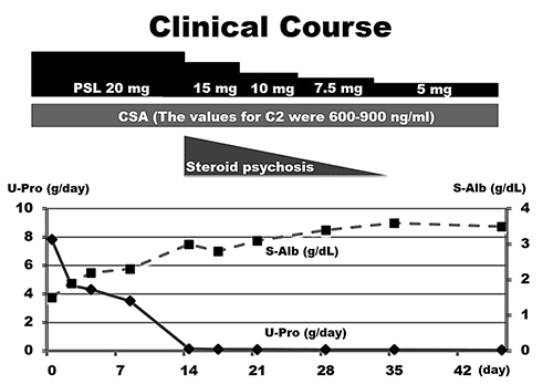 Fig. 2. Clinical course. S-Alb: serum albumin (g/dL, – ◼ –). U-Pro: urine protein (g/day, – ◆ –). Monitoring of cyclosporine was with 2-h post-dose (C2) levels. Values for C2 were 600–900 ng/mL.