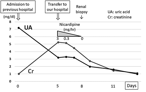 Fig. 3. Clinical course of the present case. Vasopressors that had been administered for 15 days were discontinued on admission. After transfer to our hospital, his renal function improved gradually with continuous intravenous infusion of extracellular fluids and nicardipine. The serum uric acid level decreased steadily to 1.0 mg/dL during hospitalization.