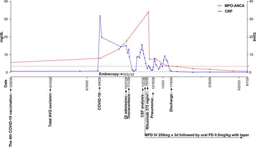 Timeline of clinical events following COVID-19 to discharge and last follow-up. Red lines or dots indicate MPO-ANCA titers, and blue lines or dots indicate CRP levels. The red dotted horizontal line represents the equivocal threshold value 3.5 (<3.5: negative, 3.5–5.0: equivocal, >5.0: positive) for MPO-ANCA measured by fluorimetric enzyme-linked immunoassay (FEIA) at Samkwang Medical Laboratories. The blue dotted horizontal lines represent the reference value 0.5 (<0.5: negative). MPO, myeloperoxidase; AVG, arteriovenous graft; ANCA, anti-neutrophil cytoplasmic antibody; CRP, C-reactive protein; COVID-19, coronavirus disease 2019; GI, gastroenterology; CSF, cerebrospinal fluid; MPD, methylprednisolone; PD, prednisolone.