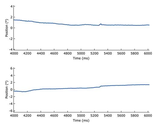 Fig. 1. Eye trace under binocular viewing conditions showing stable fixation. The upper trace shows horizontal eye movements; vertical eye movements are in the lower trace.