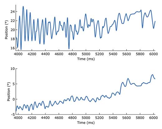 Fig. 2. Eye movement trace showing voluntary flutter in a 2-s time window. The upper trace shows horizontal eye movements; vertical eye movements are in the lower trace.