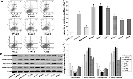 Fig. 2. S. aureus induces osteoblast apoptosis. MC3T3-E1 cells were treated with S. aureus(or S. aureus overexpressing PVL, SpA or Coa or silencing PVL, SpA or Coa), or supernatant for 24h. (A) To measure Annexin V, treated osteoblasts were re-suspended in 100μl of FITC-Annexin V antibody. Suspensions were incubated in the dark for 15 min at RT and analysed by flow cytometry. (B) Quantification of the percentage of Annexin V positive MC3T3-E1 cells subjected to different treatments. (C) Western blot analysis of caspase 3 and caspase 9. (D) Quantitative analysis of caspase 3 and caspase 9 protein levels normalized by GAPDH. All values are the means ± SD of three replicates, *p<0.05 vs uninfected, #p<0.05 vs S. aureus.