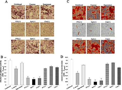 Fig. 4. S. aureus prevents osteoblast mineralisation. MC3T3-E1 cells were treated with S. aureus(or S. aureus overexpressing PVL, SpA or Coa or silencing PVL, SpA or Coa), or supernatant and incubated for 21 days. At the 7 day infection, von kossa stain was added to the osteoblasts to determine phosphate deposition. At the 7 day infection, osteoblasts were lysed with 1 ml of lysis buffer containing a substrate for alkaline phosphatase (0.1 M Na acetate, 2% Triton X-100 and 10mM p-nitrophenol phosphate) and incubated in the dark for 1 hour at 37°C, and reading absorbance at 540 nm. (C) Following a 21 day infection, alizarin red stain (2%) was added to the osteoblasts. (D) Staining was quantified by leeching the cells of the dye and reading absorbance at 540 nm. Representative images for both stains were obtained using 200× bright field microscopy. All values are the means ± SD of three replicates, *p<0.05 vs uninfected, #p<0.05 vs S. aureus.