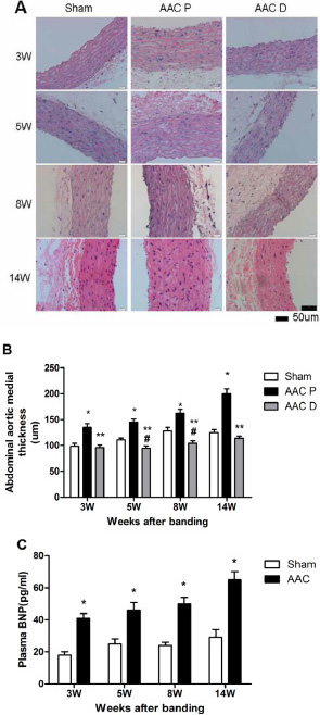 Fig. 3. (A) Representative microphotographs of hematoxylin-eosin-stained transverse sections of the abdominal aorta proximal and distal to the coarctation in the sham and AAC groups at 3, 5, 8 and 14 weeks (W) post-operatively (400×). Sham, abdominal aorta close to the coarctation in the sham group; ACC P, abdominal aorta proximal to the coarctation in the AAC group; ACC D, abdominal aorta distal to the coarctation in the AAC group. (B) The abdominal aortic medial thickness proximal and distal to the coarctation in the sham and AAC groups at 3, 5, 8 and 14 weeks (W) post-operatively. Data were obtained from 6 rats for each group. *P < 0.01 vs. age-matched sham, **P < 0.01 vs. age-matched AAC P, #P < 0.05 vs. age-matched sham. Sham, abdominal aorta close to the coarctation in the sham group; AAC P, abdominal aorta proximal to the coarctation in the AAC group; AAC D, abdominal aorta distal to the coarctation in the AAC group. (C) Plasma BNP in the sham and AAC groups. *P < 0.01 vs. age-matched sham.