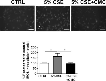 Fig. 3. CSE effect on ROS intracellular levels measured in 16-HBE cells. Examples of fluorescence microscopy original images. Each image represents a ROI (region of interest). Graphs represent the average of the mean fluorescence intensity measured in all ROIs, expressed as percentage of control condition (reported as %F compared to control (ROS intracellular levels) in the graphs) recorded in cells exposed to A) PBS (CTRL: control), 5% CSE, 5%CSE and 100 µM S-CMC-Lys (CSE + CMC) for 3 hours (n=70) . n is the number of ROIs. Scale bar = 100 µm. * = p < 0.05 with one-way Anova statistical analysis.