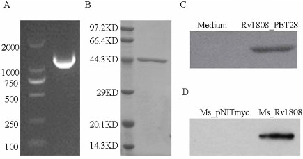 Fig. 1. The expression of Rv1808 protein. (A) PCR amplification of Rv1808 encoding gene approximately 1200bp. The detection of the expression of 45 kD Rv1808 in E.coli BL21 strain by commassie blue staining (B) and Western blotting (C). (D) The expression of myc-tagged Rv1808 protein in M. smegmatis.
