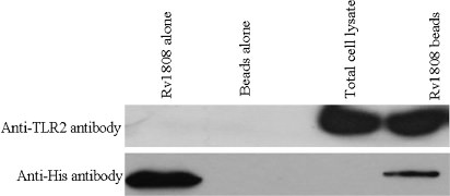Fig. 4. Rv1808 associates with TLR2. Cell lysates from U937 cells were incubated with Rv1808 immobilized on Ni-NTA beads, and bead-bound proteins were immunoblotted for the presence of TLR2. Western blotting shows the existence of Rv1808 protein by anti-his antibody.