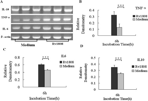 Fig. 6. Semi-quantitative RT-PCR analysis of the mRNA amount of cytokines. Macrophages were incubated with Rv1808 (5μg/ml). At 6h after infection, macrophages were washed and total RNA was extracted. Equal amounts of total RNA were subjected to RT-PCR in equal reaction volumes. DNA bands were visualized by Goldview™ staining. Similar results were obtained in three independent experiments. Results are the mean±SD of three different experiments. *, p<0.05.