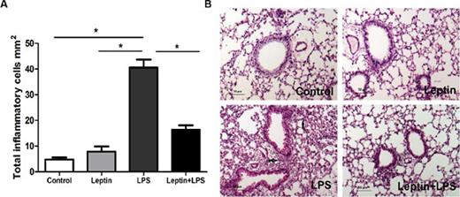 Fig. 2. Effect of leptin on LPS-induced neutrophil infiltration into the lung interstitium. Lungs were harvested after bronchoalveolar lavage collection, and embedding in paraffin. Tissues were sliced into 5μm thickness, and stained with hematoxilin-eosin. The inflammation at 6h post-LPS treatment is reduced in LPS-treated mice given leptin prior to LPS compared with those given LPS (A, B). LPS-treated mouse lung showed robust accumulation of neutrophils in the perivascular compartment (B, open arrow), accompanied by a significant increase in alveolar septal thickness (B, black arrow). The results are the means ± S.E.M. of 5 animals/group; * P< 0.05.