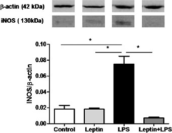 Fig. 6. Effect of leptin on LPS-induced iNOS expression in lung tissue. Lungs were harvested 6 h after challenge to quantify the expression levels of iNOS by Western blot. The graphs represent the band intensities, determined by densitometric analysis and normalized to the total β-actin present in each lane. The results are the means ± S.E.M. of 6 animals/group. * P< 0.01.