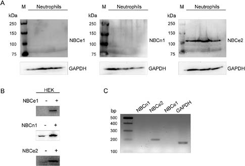 Fig. 4. Identification of the Na+/HCO3- cotransport isoforms in human neutrophils. Panel A: Human neutrophils membranes samples were resolved by SDS-PAGE on 7.5% polyacrylamide gels, transferred to PVDF membrane and probed with commercials antibodies against NBCe1, NBCn1, and NBCe2. Membranes were obtained under the same experimental conditions from neutrophils isolated from three different human beings. Panel B: Sample of lysates corresponding to unstransfected (-) human embryonic kidney (HEK293) cells, or HEK293 cells transfected (+) with NBCe1, NBCn1 and NBCe2, as controls for the antibodies used in panel A. Panel C: RT-PCR analysis of NBCe1-SLC4A4, NBCe2-SLC4A5 and NBCn1-SLC4A7 transcripts. Total RNA from isolated human neutrophils was reverse transcribed and first strand cDNA was produced using Superscript II Reverse Transcriptase. Amplicons were analysed on a 2% agarose gel containing GelRed Nucleic Acid Stain. 100-bp ladder was used.