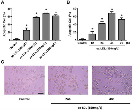 Fig. 2. Ox-LDL- induced apoptosis of cultured RAW264.7 macrophages. Apoptosis was determined by annexin V and propidium iodide dual staining followed by analysis on a flow cytometer. (A) Cells were treated with 50, 100, 150 and 200 mg· L-1 of ox-LDL for 48 h prior to analysis of apoptosis. (B) Cells were incubated with ox-LDL (150 mg· L--1) for 12, 24, 48 and 72 h. Values are expressed as means ± SD from triplicate experiments. (C) RAW264.7 cells were exposed to ox-LDL at 150 mg· L-1 for 24 h and 48 h, prior to staining and flow cytometric analysis. R: resveratrol (RSV); ox-LDL: oxidised low-density lipoprotein. * P < 0.05 indicates significant differences from the control group.