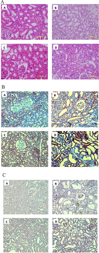 Fig. 1. A representative micrograph showing kidney histomorphology in control rat (A) and rats treated for 4 weeks with adenine (0.75% w/w in the feed) (B), gum acacia (GA, 15% w/v in drinking water) (C) or adenine + GA simultaneously) (D), using H & E (a), Trichrome Masson (b) and PAS (c) stains. No changes were seen in either untreated or gum acacia-treated controls (A and C). Marked expansion and hypercellularity of the interstitial area were noted in adenine-treated rats, along with increased amounts of collagen like material (B). These abnormalities were markedly attenuated in adenine-treated rats that also received gum acacia (D). No glomerular or vascular injury was detected in any of the groups. Bowman's capsule (arrows), polymorphonuclear cell nuclei (arrowhead) are shown.