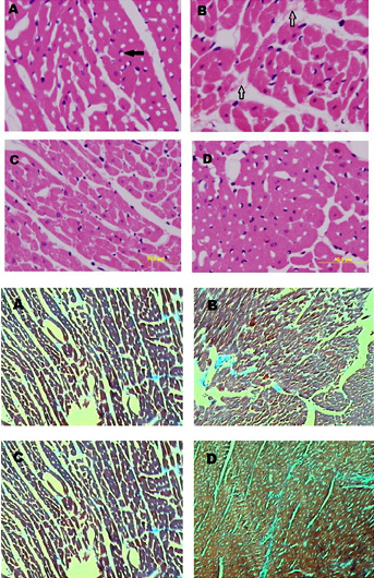Fig. 2. A representative micrograph showing left ventricle histomorphology in control rat (A) and rats treated for 4 weeks with adenine (0.75% w/w in the feed) (B), gum acacia (GA, 15% w/v in drinking water) (C) or adenine + GA simultaneously) (D), using H & E and PAS stains. Capillary (black arrow), fibrosis (white arrow) are shown.