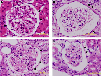 Fig. 3. cortical IN thickness (INT) in control rat (A) and rats treated for 4 weeks with adenine (0.75% w/w in the feed) (B), gum acacia (GA, 15% w/v in drinking water) (C) or adenine + GA simultaneously) (D).