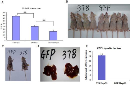 Fig. 3. miR-378 affected liver cancer cell invasion and enhanced liver cancer metastasis in a mouse model. (A) The miR-378-, anti-miR-378- and GFP-transfected HepG2 cells were inoculated on Matrigel in inserts and the invasion was measured. A greater number of miR-378-transfected HepG2 cells than GFP-transfected HepG2 cells invaded into the Matrigel. **, p<0.01 compared with GFP-HepG2 cells. (B, C) The miR-378- or GFP-transfected HepG2 cells were intraperitoneally injected into BALB/c nude mice. The mice were sacrificed and examined at 4 weeks after the injection. Four mice in the miR-378 group generated more ascitic fluid than the mice in the GFP-HepG2 group. (D) Typical metastatic lesion (white arrow) found in the livers of mice in the miR-378 group. (E) DNA was isolated from liver tissues and subjected to PCR to amplify the CMV promoter to indicate the metastasis of the tissue.