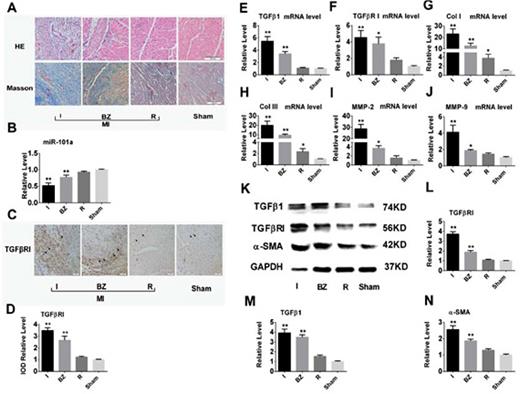 Fig. 1. Down-regulation of microRNA-101a (miR-101a) and up-regulation of transforming growth factor β receptor I (TGFβRI) expression following myocardial infarction (MI). (A) HE and Masson trichrome staining of rat heart sections demonstrated interstitial fibrosis in the infracted myocardium with collagen deposition 2 weeks after MI (10×20 magnification of 200×) (n=5). (B) Compared with sham-operated hearts, miR-101a expression was markedly decreased in the infarct zone and border zone (n=6). (C-D) Immunohistochemical staining demonstrated a significant increase in TGFβRI expression in the infarct zone and border zone (10×40 magnification of 400×) (n=6). (E-J) Compared with sham-operated hearts, mRNA levels of transforming growth factorβ1 (TGFβ1), TGFβRI, collagen I/III (Col I/III) and matrix metalloproteinase 2/9 (MMP 2/9) were increased in the infarct zone and border zone (n=6). (K-N) The protein expression levels of TGFβ1, TGFβRI and α-smooth muscle actin (α-SMA) were up-regulated in the infarct zone and border zone (n=6). I: infarct zone; BZ: border zone; R: remote zone; IOD: integrated optical density; Data are shown as mean ± SEM. *P<0.05, **P<0.01 vs. sham. Arrows denote a TGFβRI-positive region in CFs.