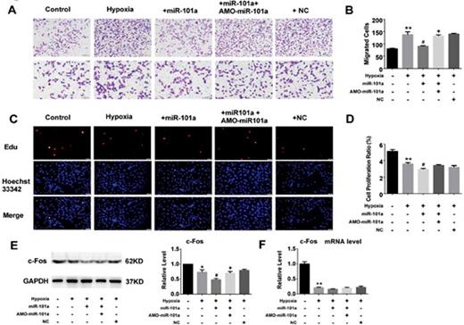 Fig. 6. The role of miR-101a in CF migration and proliferation in the setting of hypoxia. (A-B) Effect of miR-101a on the migration of cultured CFs was determined by a transwell migration assay (upper panel: 10×10 magnification of 100 ×; lower panel: 10×20 magnification of 200×). (C-D) The effect of miR-10la on the proliferation of cultured CFs was determined by an EdU proliferation assay. The proliferating cells were visualized as red, and the nuclei, as blue (10×40 magnification of 400×). (E-F) Hypoxia suppressed the protein and mRNA expression of c-Fos in CFs, which was further reduced by miR-101a. Data are shown as mean ± SEM; n =3 to 5. *P<0.05, **P<0.01 vs. control (no treatment); #P<0.05 vs. hypoxia; +P<0.05 vs. hypoxia+miR-101a. miR-101a: miR-101a mimics; AMO-miR-101a: miR-101a inhibitor; NC: negative control.