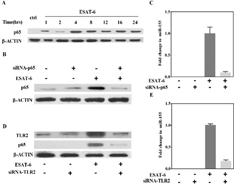 Fig. 5. ESAT-6-induced miR-155 expression is dependent on TLR2/NF-κB activation. (A) The time course of ESAT-6-induced p65 protein expression as assayed by western blotting. Macrophages were stimulated with 5 μg/ml ESAT-6 and assayed for p65 protein levels using western blotting. A representative blot of three experiments is shown. The effect of p65-specific siRNA on p65 (B) and miR-155 (C) expression in RAW264.7 cells under different treatments as indicated. The effect of TLR2-specific siRNA on TLR2, p65 (D), and miR-155 (E) expression in RAW264.7 cells under different treatments as indicated. MiR-155 was evaluated with the TaqMan microRNA assay kit using specific qRT primer sets, following the manufacturer's instructions. U6 snRNA was used for normalization. All values are expressed as means ± SEM. Each experiment was performed in triplicate.