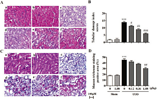 Fig. 1. Effects of HuangQi decoction on pathological changes of renal interstitial fibrosis in UUO mice models. A. HE staining; B. Scales of renal tubular injuries; C. Masson staining; D. Masson staining statistical analysis. a.sham group; b.sham+high dose group (1.08g/kg); c.UUO group; d.UUO+low dose group (0.12g/kg); e.UUO+middle dose group (0.36g/kg); f.UUO+high dose group (1.08g/kg). *** P < 0.001, compared with the sham group; # P<0.05, ## P<0.01, ### P<0.001, compared with the UUO group. n=12-15.