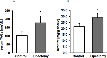 Fig. 1. Triglyceride levels in: A) serum and B) liver of the controls and lipectomized rats. Data presented as mean ± SD. * p< 0.05.