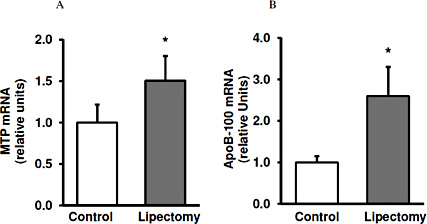 Fig. 2. The meanA) microsomal TAG transfer protein (MTP) and B) Apo-lipoprotein B-100 (ApoB-100) relative mRNA levels in the livers of the controls and lipectomized rats. Data presented as mean ± SD. * p< 0.05.