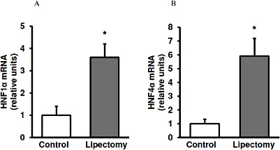 Fig. 3. The mean A) hepatocyte nuclear factor 1α (HNF1α) and B) hepatocyte nuclear factor 4α (HNF4α) relative mRNA levels in the livers of the controls and lipectomized rats. Data presented as mean ± SD. * p< 0.05.