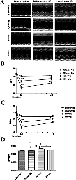 Fig. 2. QL preserves cardiac function after I/R. (A) Representative M-mode images of operated mice at pre-I/R, 24 hours and 7 days after I/R. (B-C) LVEF and LVFS analysis at pre-I/R, 24 hours and 7 days after I/R. ***P< 0.001 versus sham- operated mice, ++P<0.01 I/R+QL versus I/R+NS, +P<0.05 I/R+QL versus I/R+NS. (D) Heart weight/body weight (HW/BW) ratios at 7 days after I/R (n=10, sham-operated mice; n=20, QL treated mice; n=13, untreated mice). **P<0.01 I/R+NS versus sham-operated mice, *P<0.05 I/R+QL versus I/R+NS.