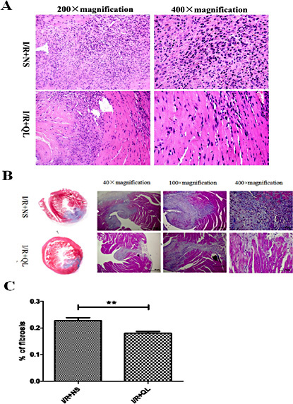 Fig. 4. QL improves pathological changes in myocardial tissue after I/R. (A) Representative micrographs of I/R mouse hearts after H&E staining. These images demonstrated intense inflammatory infiltration and myocardial cells arranged irregularly after I/R. (B) Representative images of Masson's trichrome-stained hearts from I/R mice. Blue indicates fibrosis. (C) Quantitative analysis of interstitial fibrosis examined by Masson's trichrome staining. Percent fibrosis was determined using Image J software to quantify blue (fibrotic) versus non-blue (non-fibrotic) pixels (n=6). **P<0.01 I/R+QL vs I/R+NS.