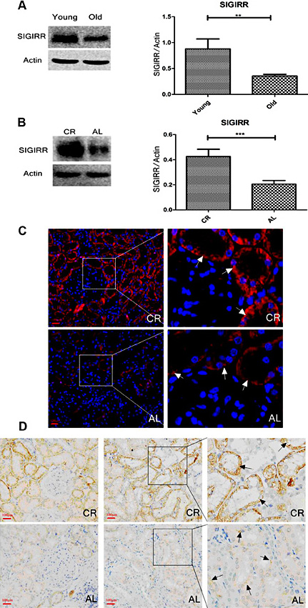 Fig. 4. Changes in SIGIRR expression. A. Western blotting shows high expression in young rats compared with old rats. B. Western blotting shows high expression in the CR group compared with the AL group. C. Immunofluorescence results show that positive granular staining for SIGIRR was generally located on the lateral membrane of renal tubular epithelial cells, whereas there was markedly little staining in the glomerulus (indicated by white arrows). Moreover, the AL group showed high fluorescence intensity compared with the CR group. D. Immunohistochemical staining shows similar results, with positive granular staining for SIGIRR generally located on the lateral membrane of renal tubular epithelial cells (indicated by black arrows) and a higher intensity of SIGIRR expression in the CR group (compared with the AL group, * p<0.05, **p<0.01, ***p<0.001, n=6 per group).
