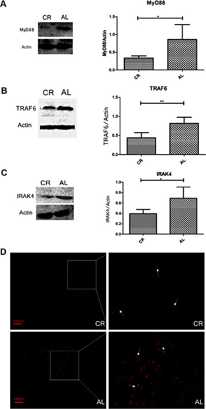 Fig. 5. Changes in MyD88, IRAK4 and TRAF6 expression. A. Western blotting shows low MyD88 expression in the CR group compared with the AL group. B. Western blotting shows that IRAK4 expression was decreased in CR rats compared with the AL control rats. C. Western blotting shows that TRAF6 expression was decreased in CR rats compared with the AL control rats. D. Immunofluorescence results show that positive granular staining for MyD88 was generally located in the basement membrane of renal tubular epithelial cells (indicated by white arrows) and that the CR group exhibited lower fluorescence intensity compared with the AL group (compared with the AL group, * p<0.05, ** p<0.01, n=6 per group).