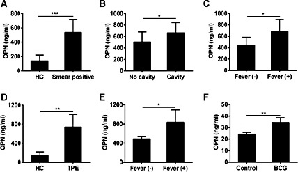 Fig. 1. Increased OPN levels in patients with TB. Plasma OPN levels in smear-positive pulmonary TB patients (A) and TPE patients (D) were measured by ELISA, and compared to that in healthy controls (HC). The plasma OPN levels were compared in smear-positive pulmonary TB patients (B) with or without cavitation. OPN concentrations in smear-positive pulmonary TB patients (C) and TPE patients (E) with or without fever. (F) OPN levels in culture supernatants of A549 cells incubated with BCG (15 μg/mL) for 24 h. Data represent the mean ± SD. *, P < 0.05. **, P < 0.01. ***, P < 0.001.