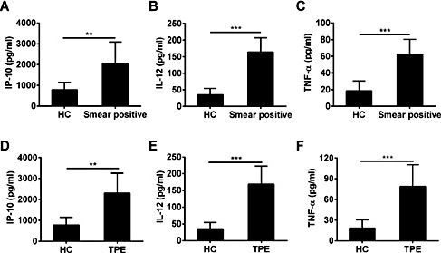 Fig. 2. Increased expression of chemokines and cytokines in patients with TB. IP-10 (A), TNF-α (B), and IL-12 (C) levels in the plasma of smear-positive pulmonary TB patients and healthy individual controls were compared before treatment by ELISA. The plasma levels of IP-10 (D), TNF-α (E), and IL-12 (F) in TPE patients were detected. Data represent the mean ± SD. *, P < 0.05. **, P < 0.01. ***, P < 0.001.
