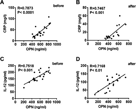 Fig. 5. Correlation between OPN and CRP or IL-12 levels both before and after anti-TB treatment. There was a significant positive correlation between OPN and CRP in smear-positive pulmonary TB patients before (A) (R = 0.7873, P < 0.0001) and after (B) (R = 0.7467, P < 0.001) initiation of anti-TB therapy. Correlation between the OPN and IL-12 in smear-positive pulmonary TB patients before (C) (R = 0.7518, P < 0.001) and after (D) (R = 0.7168, P < 0.01) initiation of anti-TB therapy was examined. Each symbol indicated one patient and the line represented the regression line. Data represent the mean ± SD. *, P < 0.05. *, P < 0.01. ***, P < 0.001.