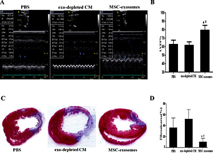 Fig. 3. Functional effects of exosomes in vivo. (A) Exosomes improve echocardiographic performance of the infracted heart at 4 weeks after myocardial infarction. Representative echocardiographic images from at least six cardiac contractile cycles of the hearts from control and experimental rats are provided. (B) The mean percentages of the left ventricular ejection fraction were calculated. * P < 0.05 vs. exosome-depleted CM, # P < 0.05 vs phosphate-buffered saline (PBS) (C) Micrography showed the infract size using Masson trichrome staining in various groups 4 weeks post-infarction. Blue represents the infarction part of myocardial fibrosis tissue. Red represents the normal myocardium tissue. (D) Quantification of infarct size in various groups. Data represent the means (* P < 0.05 vs. exo-depleted CM, # P < 0.05 vs. PBS).