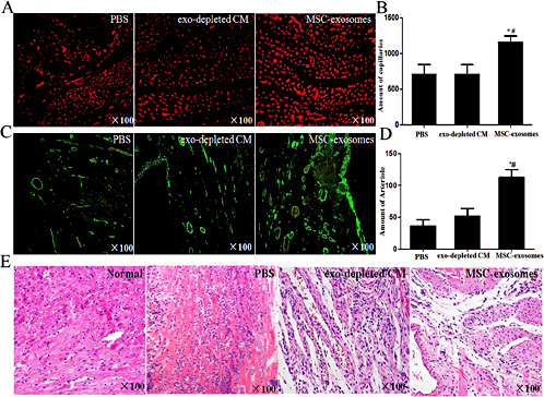 Fig. 4. Exosomes promote neoangiogenesis and decrease the inflammation in the infracted zone. The heart tissue sections were stained by Griffonia Simplicifolia lectin I (red) and alpha-smooth muscle actin (green). Blood vessel density in the infarcted zone was counted and compared among three groups. The new functional capillary density was measured by Griffonia Simplicifolia lectin I (A-B) (*P < 0.05 vs. exo-depleted CM, # P < 0.05 vs. PBS). Newly formed blood vessels were counted as α-SMA under the fluorescence microscope (C-D) (*P < 0.05 vs. exo-depleted CM, # P < 0.05 vs. PBS). Inflammation infiltration in myocardial infarction tissue was observed by HE staining (E).